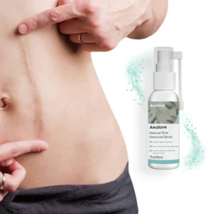 Awzlove™ Natural Scar Removal Spray