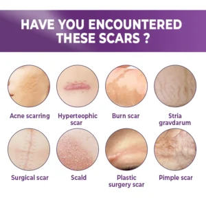 BIOCLEAR™ Silicone Scar Reduction Sheets