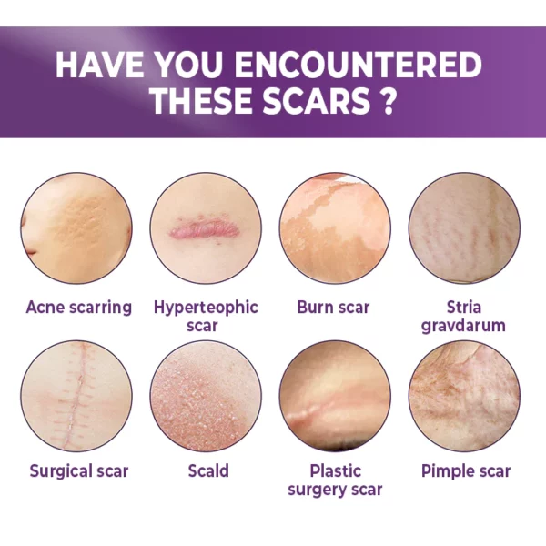 BIOCLEAR™ Silicone Scar Reduction Sheets