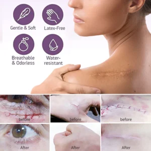 BIOCLEAR™ Silicone Scar Reduction Sheets