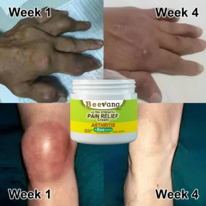 Beevana™ Bee Venom Joint and Bone Therapy Cream