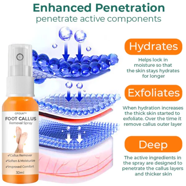 CC™ Foot Callus Removal Spray