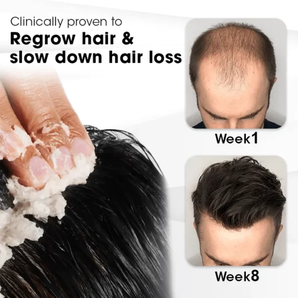 CC™ PrestigeStrand Hair Regrowth Scrub - Image 5