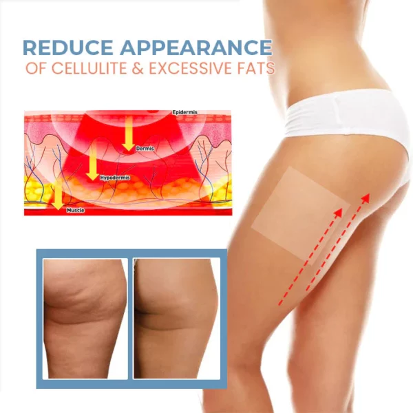 CC™ TightenCell Anti-Cellulite Collagen Firming Patches