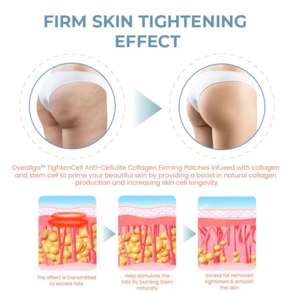 CC™ TightenCell Anti-Cellulite Collagen Firming Patches