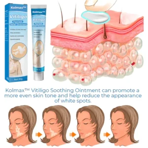 CC™ Vitiligo Soothing Ointment