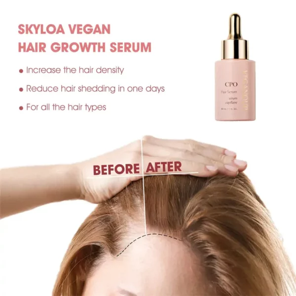 CPO™ Follicle Nourishing HairGrowth Serum - Image 3