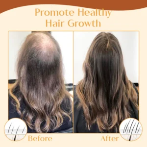 Ceoerty™ Hair Restore Anti-Thinning Shampoo