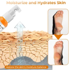 Croaie™ Anti Foot Callus Removal Spray