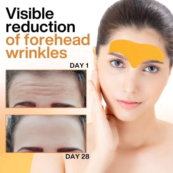 DermaBliss™ Forehead Wrinkle Patch