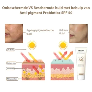 GFOUK™ Anti-Pigment SPF 50 Probiotische Dagcrème