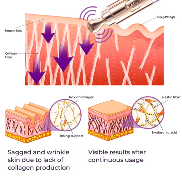 GFOUK™️ Milk Spots Therapy Electric Serum Pen