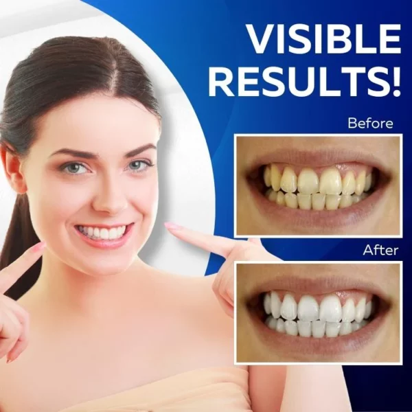 Gleam3D™ Teeth Whitening Strips