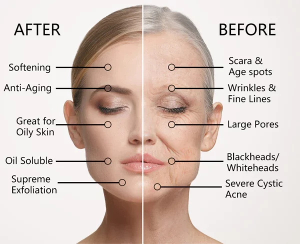 KSOM Anti-Aging & Anti-Wrinkle Serum - Image 3