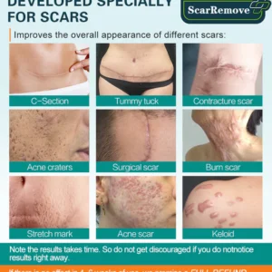 KlearScar™ Advanced scar removal gel