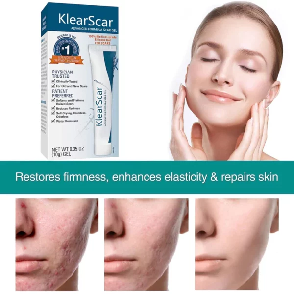 KlearScar™ Advanced scar removal gel