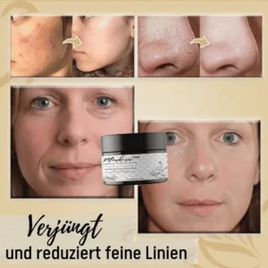 Maskiss™ Kräuter-Peel-Off-Maske