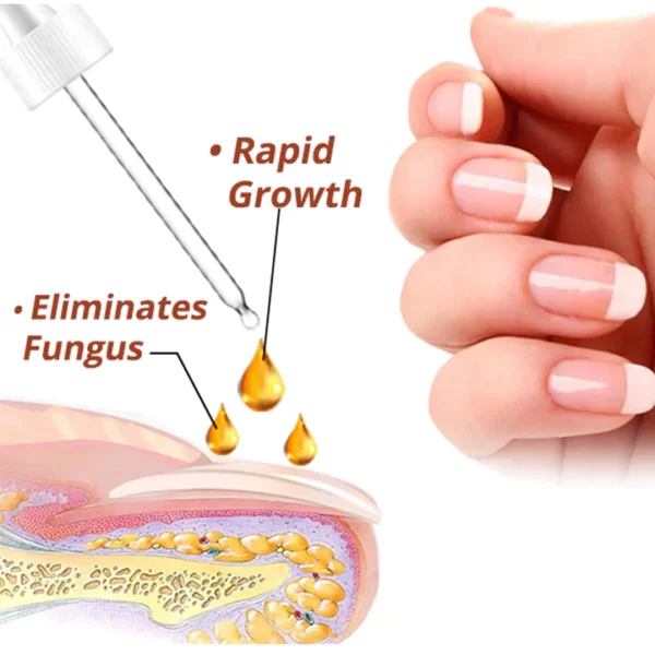 NailGr™ Sérum de croissance et de renforcement des ongles de 7 jours - Image 3