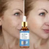 Oveallgo ™ Youthfully Botox Face Serum