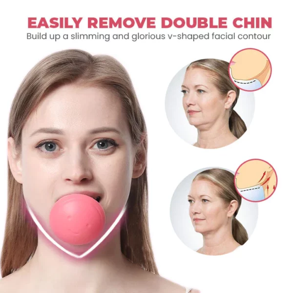 Oveallgo™ Double Chin Removal V-Face Suction Trainer - Image 3