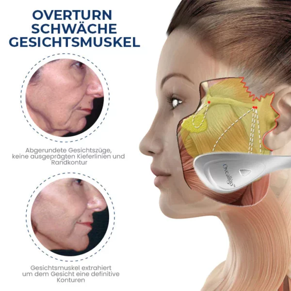 Oveallgo™ JawFit Pro Gesichtsskulptor - Image 6