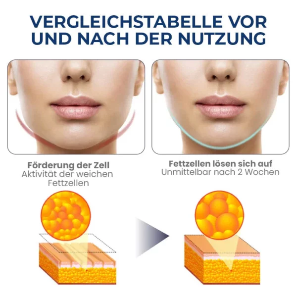 Oveallgo™ JawFit Pro Gesichtsskulptor - Image 7