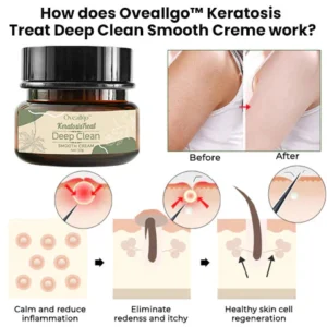 Oveallgo™ Keratosis Treat Deep Clean Smooth Creme