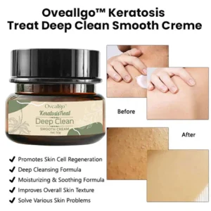 Oveallgo™ Keratosis Treat Deep Clean Smooth Creme