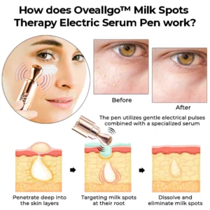 Oveallgo™ Milk Spots Therapy Electric Serum Pen