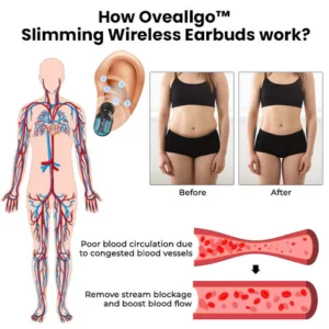 Oveallgo™ Slimming Wireless Earbuds