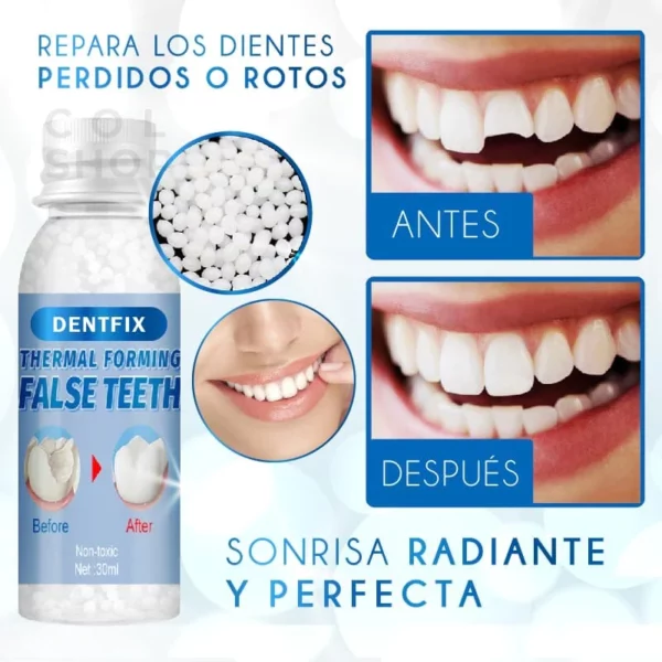 Oveallgo™ Tooth Repair Granules