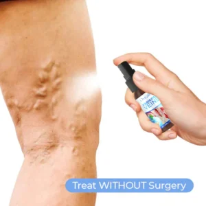 Oveallgo™ Varicose Veins Spray