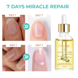 Oveallgo™ XtraRich Vitamin Nail Strengthening Cuticle Oil