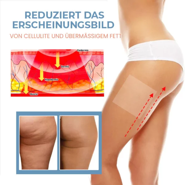 Oveallgo™ Zelle Straffen Anti-Cellulite Kollagen-Straffungspflaster - Image 3