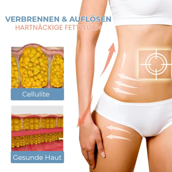 Oveallgo™ Zelle Straffen Anti-Cellulite Kollagen-Straffungspflaster - Image 6