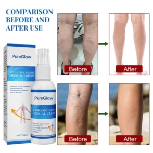 PureGlow™ Varicose Veins Treatment Spray