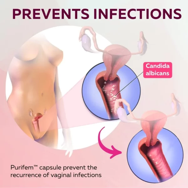 Purifem™ Feminine Care Capsules