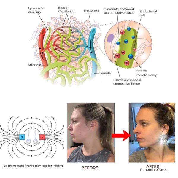 RKOL™ Lymphatic Magnetic Therapy Earrings - Image 3