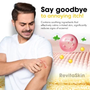 RevitaSkin™ Eczema Cure Cream