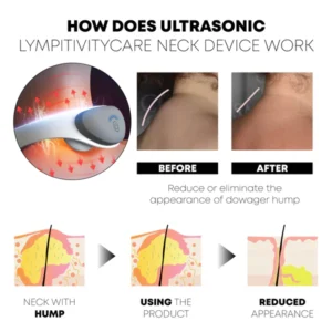 Ricpind Ultrasonic LympvityCare Neck Device