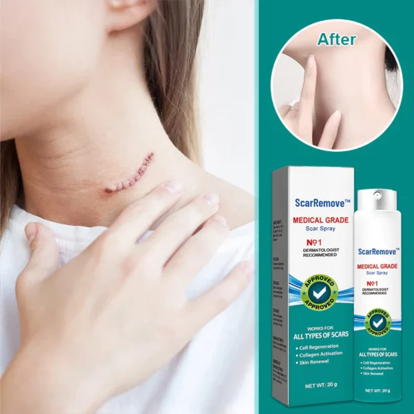 ScarRemove™ Scar and Stretch Mark Refining Spray - Image 2