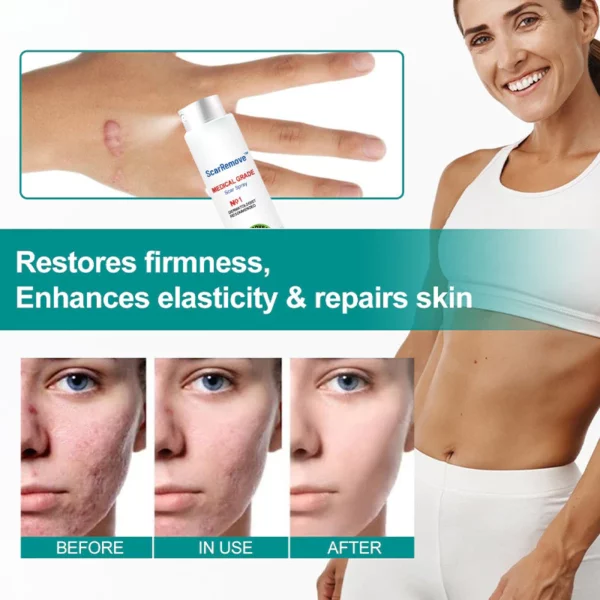 ScarRemove™ Scar and Stretch Mark Refining Spray - Image 3