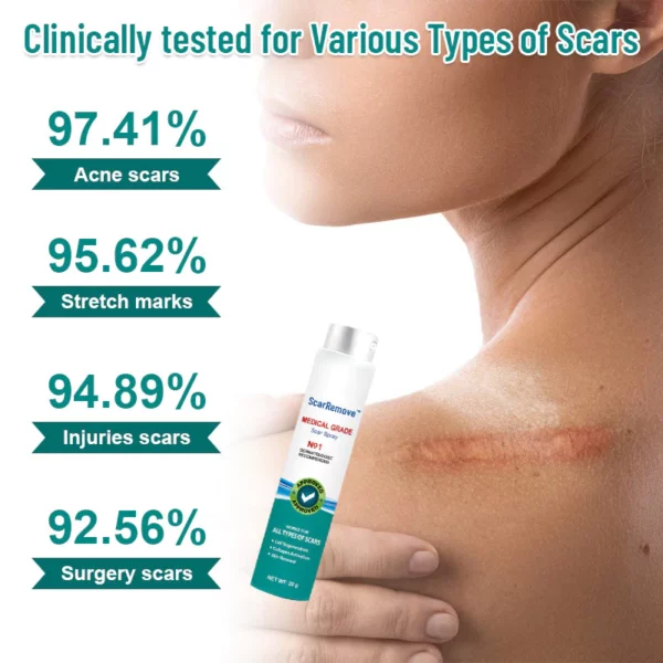 ScarRemove™ Scar and Stretch Mark Refining Spray - Image 4