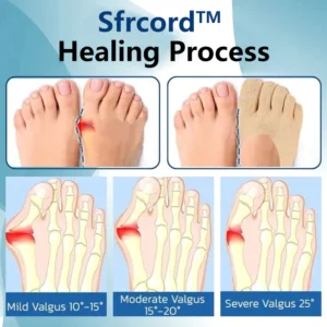 Sfrcord™ Bunion-Relief Socks