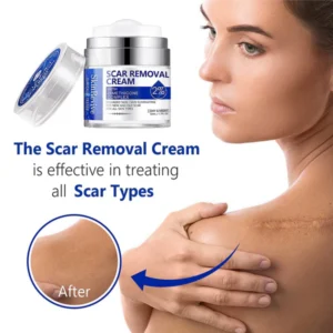 SkinRevive™ Advanced scar cream