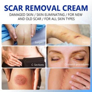 SkinRevive™ Advanced scar cream