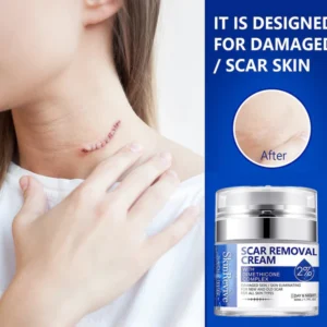 SkinRevive™ Advanced scar cream