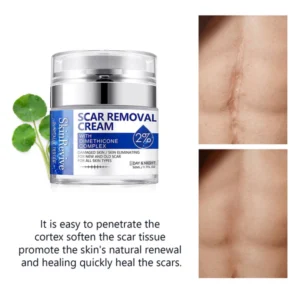 SkinRevive™ Advanced scar cream