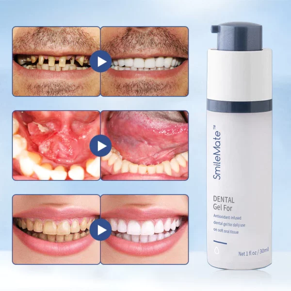 SmileMate™ Teeth Whitening Repair Regrowth Dental Gel - Image 5