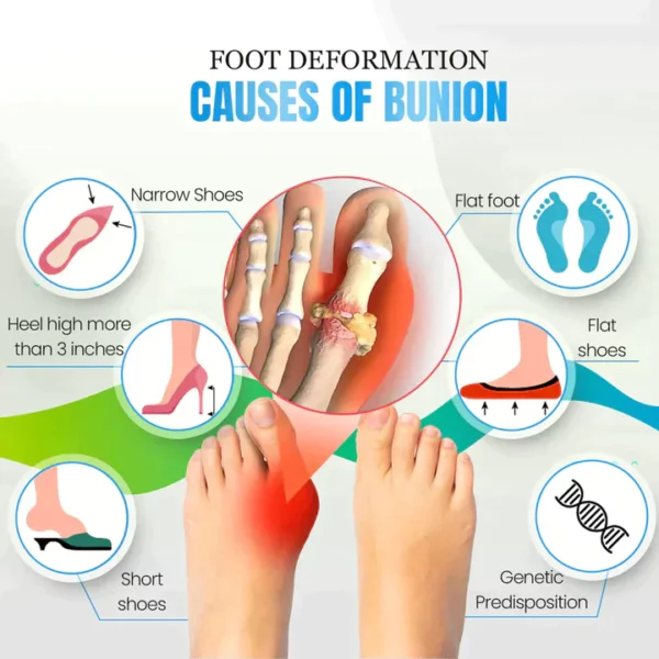 Anti-Bunions Health Socks - Image 8